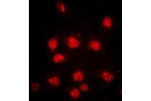 Immunofluorescent analysis of RB1 (pS807) staining in HeLa cells. (Retinoblastoma 1 antibody  (C-Term, pSer807))
