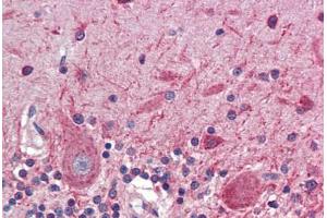 Human Brain, Cerebellum (formalin-fixed, paraffin-embedded) stained with ATF4 antibody ABIN462203 followed by biotinylated goat anti-rabbit IgG secondary antibody ABIN481713, alkaline phosphatase-streptavidin and chromogen. (ATF4 antibody  (N-Term))