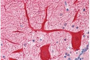 Human Brain, Cerebellum (formalin-fixed, paraffin-embedded) stained with OPTN antibody ABIN364456 at 2. (OPTN antibody  (AA 559-575))