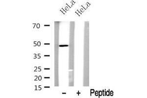 Western blot analysis of BCL-3 in lysates of HeLa? (BCL3 antibody  (C-Term))