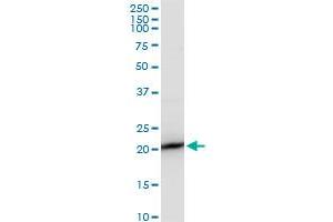 SAT polyclonal antibody (A01), Lot # 051213JC01. (SAT1 antibody  (AA 88-171))