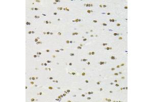 Immunohistochemistry of paraffin-embedded rat brain using RBPJKK Antibody (ABIN6131815, ABIN6146805, ABIN6146806 and ABIN6221327) at dilution of 1:100 (40x lens). (RBPJ antibody  (AA 1-260))