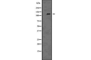 Western blot analysis of EPHB6 using COLO205 whole cell lysates
