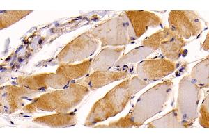 Detection of NRP1 in Human Skeletal muscle Tissue using Monoclonal Antibody to Neuropilin 1 (NRP1) (Neuropilin 1 antibody  (AA 646-814))