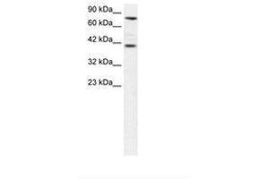 Image no. 1 for anti-Zinc Finger Protein 652 (ZNF652) (AA 97-146) antibody (ABIN6735826) (ZNF652 antibody  (AA 97-146))