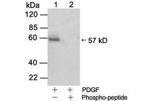 Western blot analysisLane 1: Cell lysate from NIH/3T3 cells stimulated with 50 ng/ml PDGFLane 2: Cell lysate from NIH/3T3 cells stimulated with 50 ng/ml PDGF and blocked with phosphopeptidePrimary Antibody: Rabbit Anti-Akt (Phospho-Ser473) Polyclonal Antibody (ABIN398632) Secondary Antibody: 0.