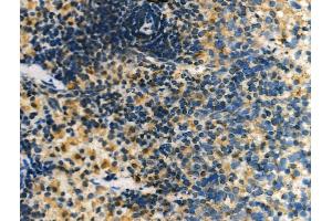 ABIN6261308 and ABIN6276956 at 1/100 staining Rat liver tissue by IHC-P. (DLC1 antibody  (N-Term))