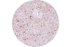 Cerebrum grey matter with a strong nuclear and cytoplasmic PSAT1 staining of astrocytes