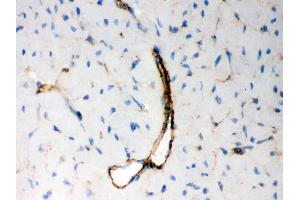 Immunohistochemistry (IHC) image for anti-BCL2-Antagonist/killer 1 (BAK1) (AA 22-211) antibody (ABIN3042342)