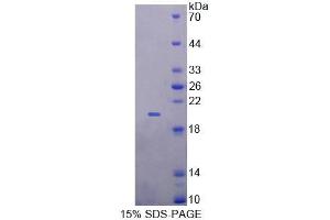 SDS-PAGE analysis of Human GALR4 Protein. (GPR151 Protein)