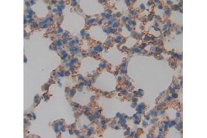 Used in DAB staining on fromalin fixed paraffin- embedded lung tissue (ABCD4 antibody  (AA 356-606))