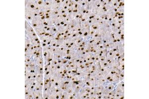 Immunohistochemistry (IHC) image for anti-GATA Binding Protein 4 (GATA4) antibody (ABIN7267359)