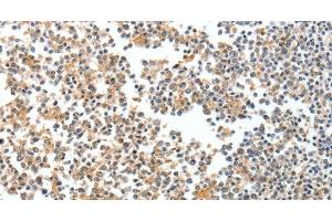 Immunohistochemistry of paraffin-embedded Human tonsil tissue using SPDEF Polyclonal Antibody at dilution 1:60 (SPDEF/PSE antibody)