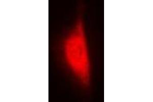 Immunofluorescent analysis of WBSCR22 staining in MCF7 cells. (WBSCR22 antibody)