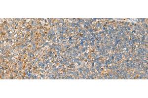 Immunohistochemistry of paraffin-embedded Human tonsil tissue using NQO2 Polyclonal Antibody at dilution of 1:70(x200) (NQO2 antibody)