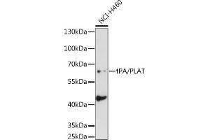 Western blot analysis of extracts of NCI-H460 cells, using tPA/tPA/PLAT antibody (ABIN6128802, ABIN6145743, ABIN6145744 and ABIN6221299) at 1:1000 dilution. (PLAT antibody  (AA 23-320))