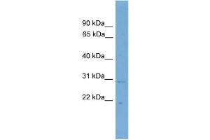 WB Suggested Anti-CNPY3  Antibody Titration: 0. (TNRC5 antibody  (N-Term))