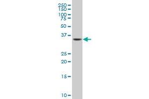 NKX2-5 monoclonal antibody (M03), clone 3A7 Western Blot analysis of NKX2-5 expression in C32 . (NK2 Homeobox 5 antibody  (AA 1-130))