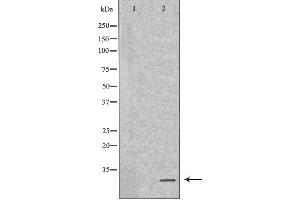 Western blot analysis of GST-SPINK1 recombinant protein using SPINK1 antibody. (SPINK1 antibody  (Internal Region))