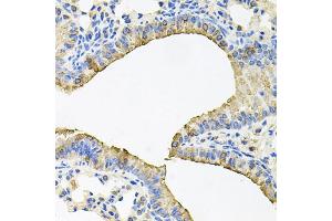 Immunohistochemistry of paraffin-embedded mouse lung using SKAP2 antibody.
