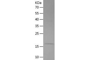 Western Blotting (WB) image for Creatine Kinase, Brain (CKB) (AA 1-125) protein (His tag) (ABIN7283635) (CKB Protein (AA 1-125) (His tag))