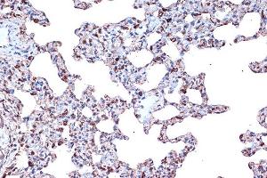 Immunohistochemistry of paraffin-embedded rat lung using PDCD4 Rabbit mAb  at dilution of 1:100 (40x lens). (PDCD4 antibody)
