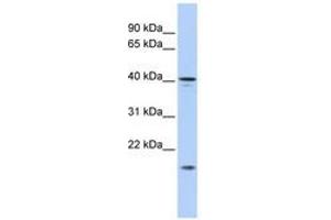 Image no. 1 for anti-SLAIN Motif Family, Member 1 (SLAIN1) (AA 221-270) antibody (ABIN6741157) (SLAIN1 antibody  (AA 221-270))