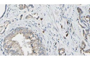 ABIN6278532 at 1/100 staining Human prostate tissue by IHC-P. (STEAP1 antibody  (N-Term))