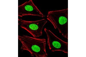 Fluorescent image of Hela cells stained with POLDIP3 Antibody (N-term) (ABIN1881667 and ABIN2838983).