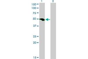 Western Blot analysis of SMOC1 expression in transfected 293T cell line by SMOC1 monoclonal antibody (M03), clone 8F10. (SMOC1 antibody  (AA 150-221))