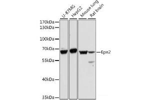 Western blot analysis of extracts of various cell lines using Epn2 Polyclonal Antibody at dilution of 1:1000. (Epsin 2 antibody)