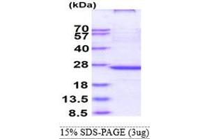 SDS-PAGE (SDS) image for Oxidized Low Density Lipoprotein (Lectin-Like) Receptor 1 (OLR1) (AA 58-273) protein (ABIN667547) (OLR1 Protein (AA 58-273))