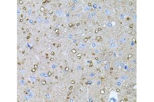 Immunohistochemistry of paraffin-embedded Rat brain using NTF4 Polyclonal Antibody at dilution of 1:100 (40x lens). (Neurotrophin 4 antibody)