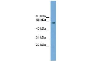 Western Blotting (WB) image for anti-Resistance To Inhibitors of Cholinesterase 8 Homolog A (C. Elegans) (RIC8A) (N-Term) antibody (ABIN2787279)