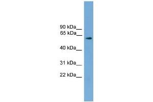 WB Suggested Anti-RIC8A Antibody Titration: 0. (RIC8A antibody  (N-Term))