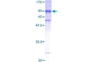 MEIS3 Protein (AA 1-421) (GST tag)