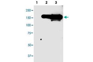 Western blot analysis of GFP tag monoclonal antibody, clone 946as  in 10 ug lysate from GFP fusion protein prositive 293 cells.