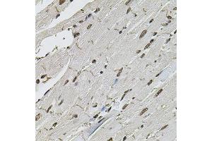 Immunohistochemistry of paraffin-embedded mouse heart using CTNNB1 antibody (ABIN5997534) at dilution of 1/100 (40x lens). (CTNNB1 antibody)