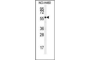 Image no. 1 for anti-Cytochrome P450, Family 21, Subfamily A, Polypeptide 2 (CYP21A2) (AA 66-95), (N-Term) antibody (ABIN360246)