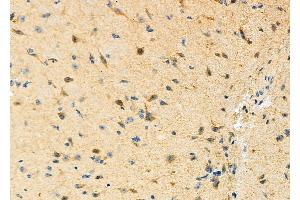 ABIN6265330 and ABIN6273170 at 1/100 staining Mouse brain tissue by IHC-P.