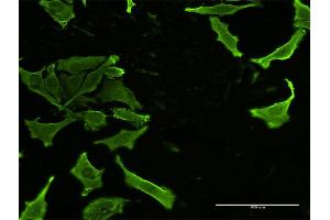 Immunofluorescence of monoclonal antibody to CKS2 on HeLa cell. (CKS2 antibody  (AA 1-79))