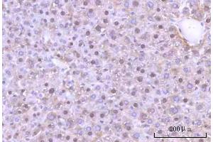 IHC analysis of Nesprin3/SYNE3 using anti-Nesprin3/SYNE3 antibody (ABIN7601328). (Nesprin3 antibody  (AA 322-495))