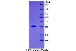 SDS-PAGE (SDS) image for Bone Morphogenetic Protein 15 (BMP15) (AA 266-388) protein (His tag) (ABIN1879998)