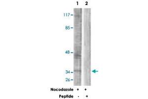 Western blot analysis of extracts from COS-7 cells, treated with Nocodazole (1 ug/mL, 16 hours), using PBK polyclonal antibody .