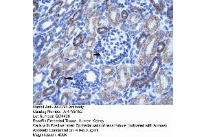 Human kidney (ASIC3 antibody  (N-Term))