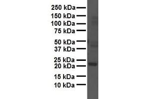 WB Suggested Anti-GAMT antibody Titration: 1 ug/mL Sample Type: Human liver (GAMT antibody  (Middle Region))