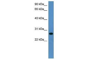 Western Blot showing Cyb5r2 antibody used at a concentration of 1-2 ug/ml to detect its target protein. (CYB5R2 antibody  (C-Term))