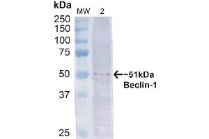 Western blot analysis of Human Cervical cancer cell line (HeLa) lysate showing detection of ~51 kDa Beclin 1 protein using Rabbit Anti-Beclin 1 Polyclonal Antibody (ABIN2868749). (Beclin 1 antibody  (APC))