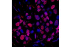 Immunofluorescence (IF) image for anti-RAD23 Homolog B (RAD23B) (AA 359-409) antibody (ABIN7449006) (RAD23B antibody  (AA 359-409))