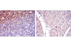 Immunohistochemical analysis of paraffin-embedded human cerebellum tissues (left) and human liver cancer tissues (right) using CD15 mouse mAb with DAB staining.